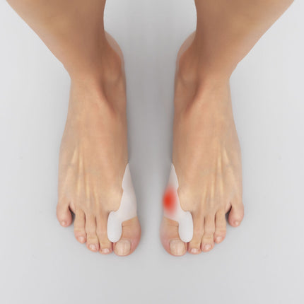 InnovaGoods Gel Metatarsal Pads and Bunion Protectors, Silicone, 2 Units Each